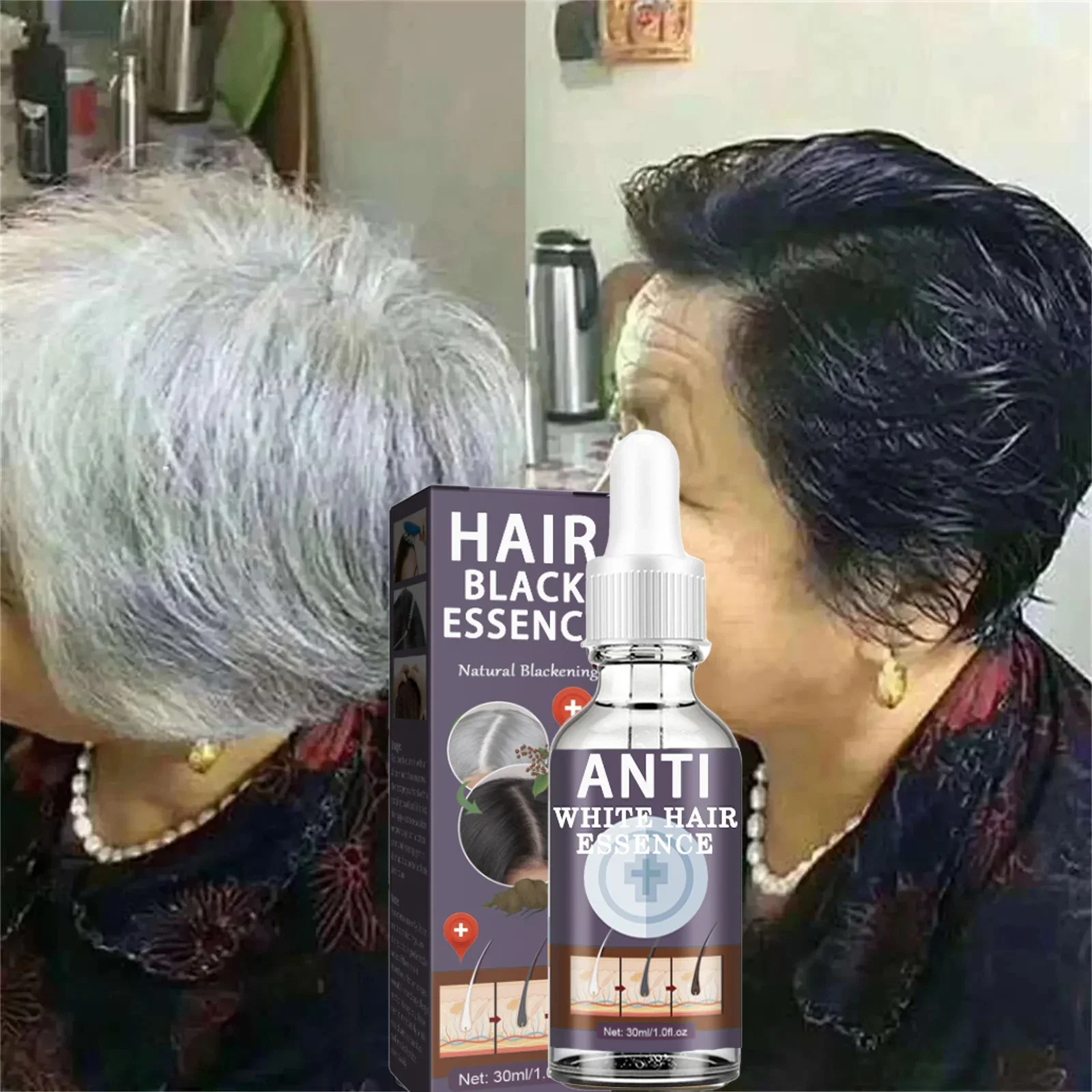 White hair killer, remove gray hair and restore natural hair color in 7 days