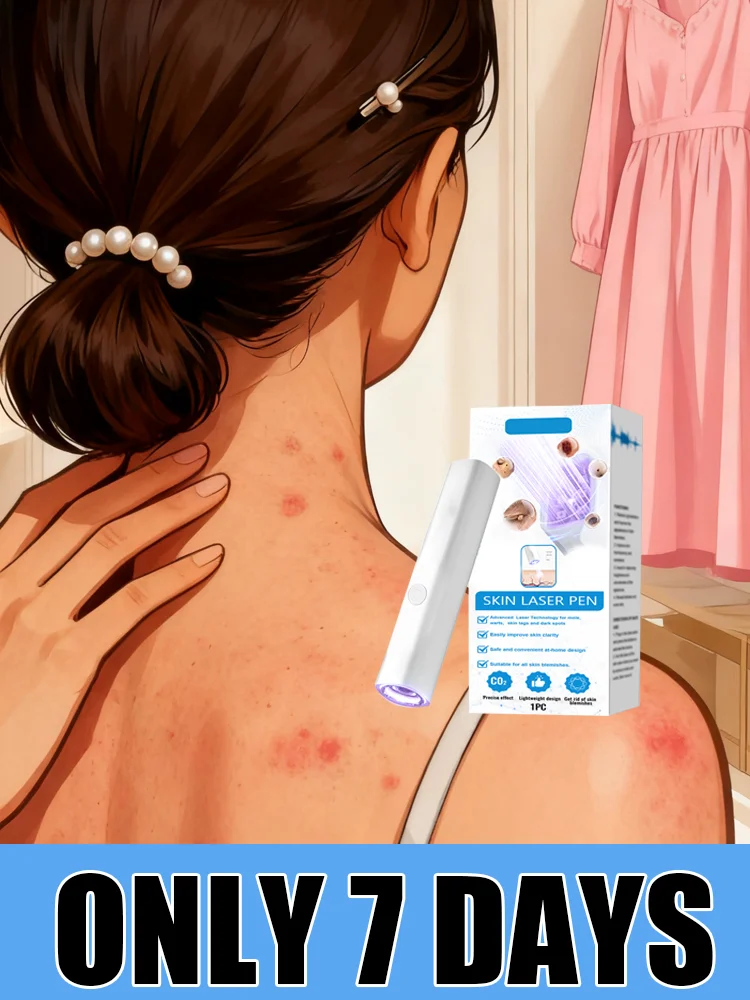 

2nd ᵍᵉⁿᵉʳᵃᵗⁱᵒⁿ ᵘᵖᵍʳᵃᵈᵉᵈ wᵃʳᵗ ⸴ ᑫᵘⁱᶜᵏˡʸ， ʳᵉpᵃⁱʳ wᵃʳᵗˢ ʳᵒoᵗ 66