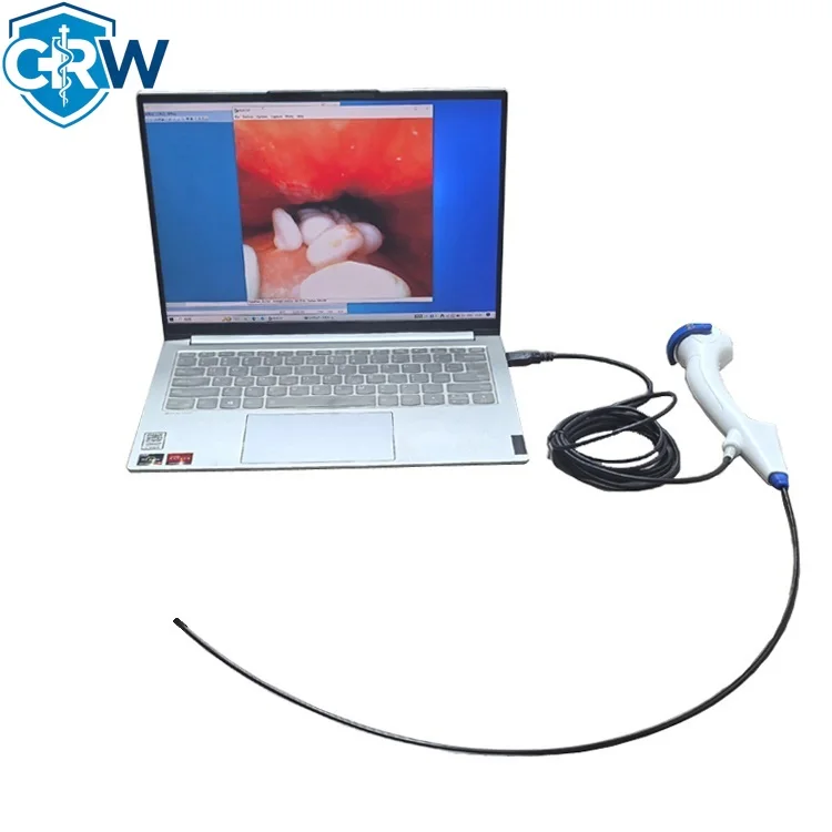 CRW Y2810 Hot Sale Flexible Fiber Ureteroscopy Medical Equipment Light Source Pyeloscopy for Veterinary Use