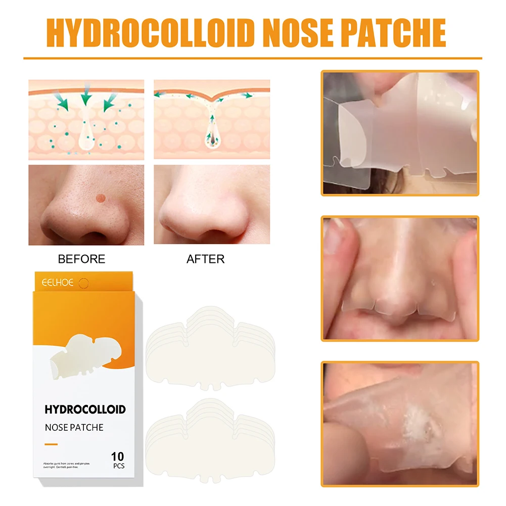 Nose Patch 10pcs Nose Acne Pore Cleaner Sticker for Nose Pores Pimples (Beige)