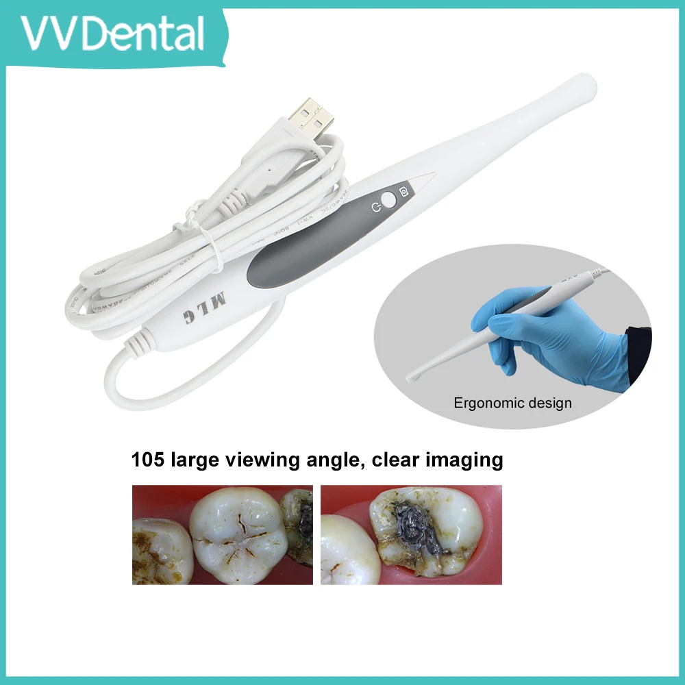 Category image: Intraoral Camera