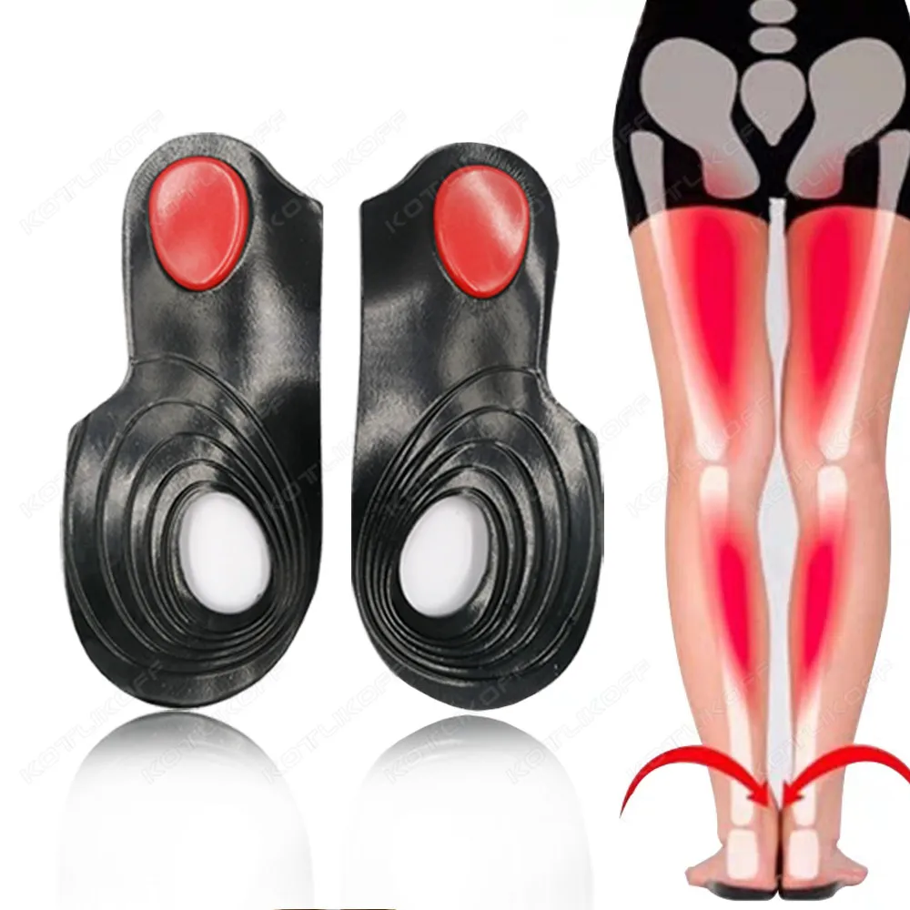 نعال تقويم العظام من هلام السيليكون للعناية بالقدمين ، نعل تدليك مغناطيسي ، نوع الساق O X ، تصحيح الأروح والفاروس ، التهاب اللفافة الأخمصية #2
