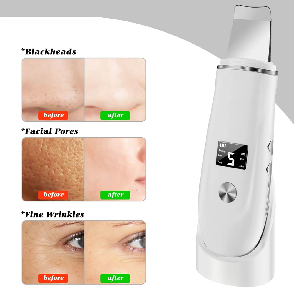 ทําความสะอาดใบหน้าอัลตราโซนิกเครื่องขัดผิวการสั่นสะเทือน Face Spatula Blackhead Remover Cavitation Peeling Facial Lifting Skin Care เครื่องมือ