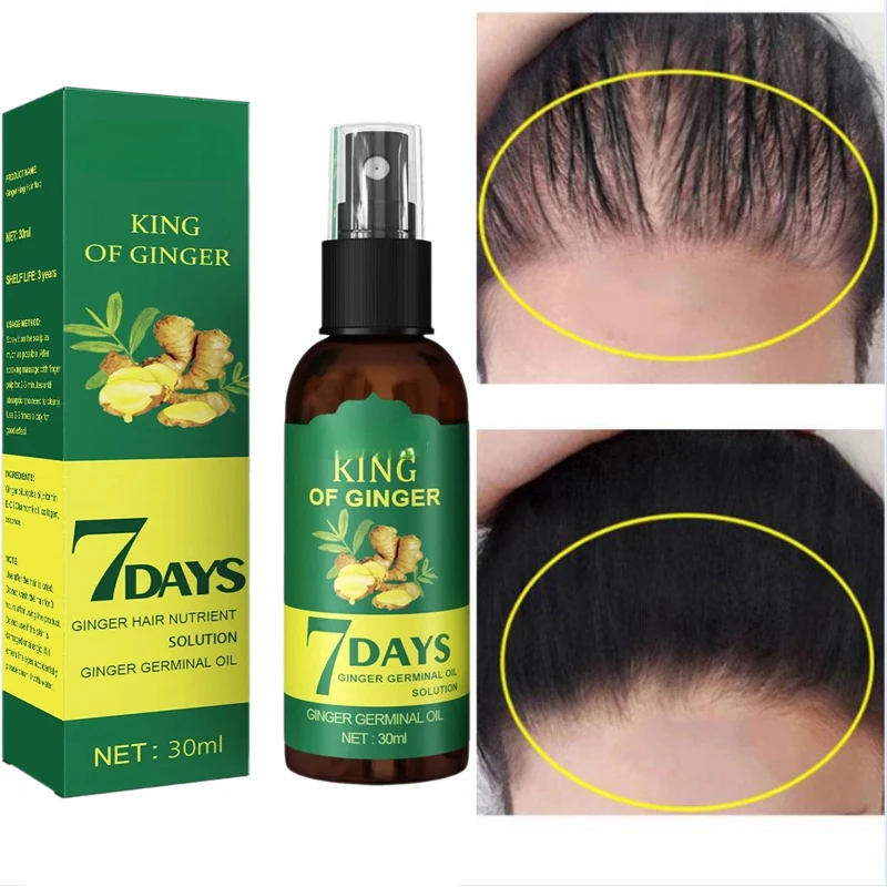 Fast Hair Growth Oil Anti Alopecia Repair Baldness Hair Follicles Hereditary Hair Loss Postpartum Loss Seborrheic Care