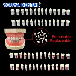 28 sztuk/zestaw praktyka dentystyczna endodontyczny blok kanału korzeniowego RCT pełne usta blok kanału korzeniowego szkolenie ząb Endo Pulp Cavity Model do nauki