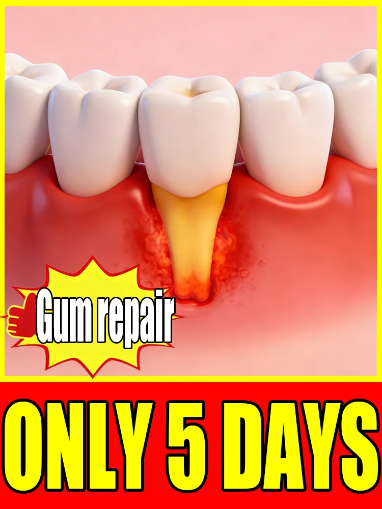 With ᴇᴀsᴇ restore gum health and blanket teeth ᴏᴠᴇʀ ᴀ 5-ᴅᴀʏ ᴘᴇʀɪᴏᴅ