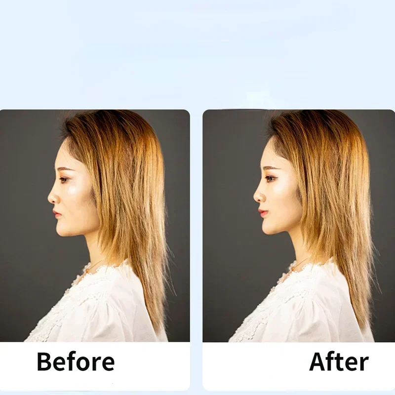 Elastyczne paski do liftingu oczu i brwi, klips BB, regulowana gumka do włosów, taśmy przeciwzmarszczkowe do twarzy.