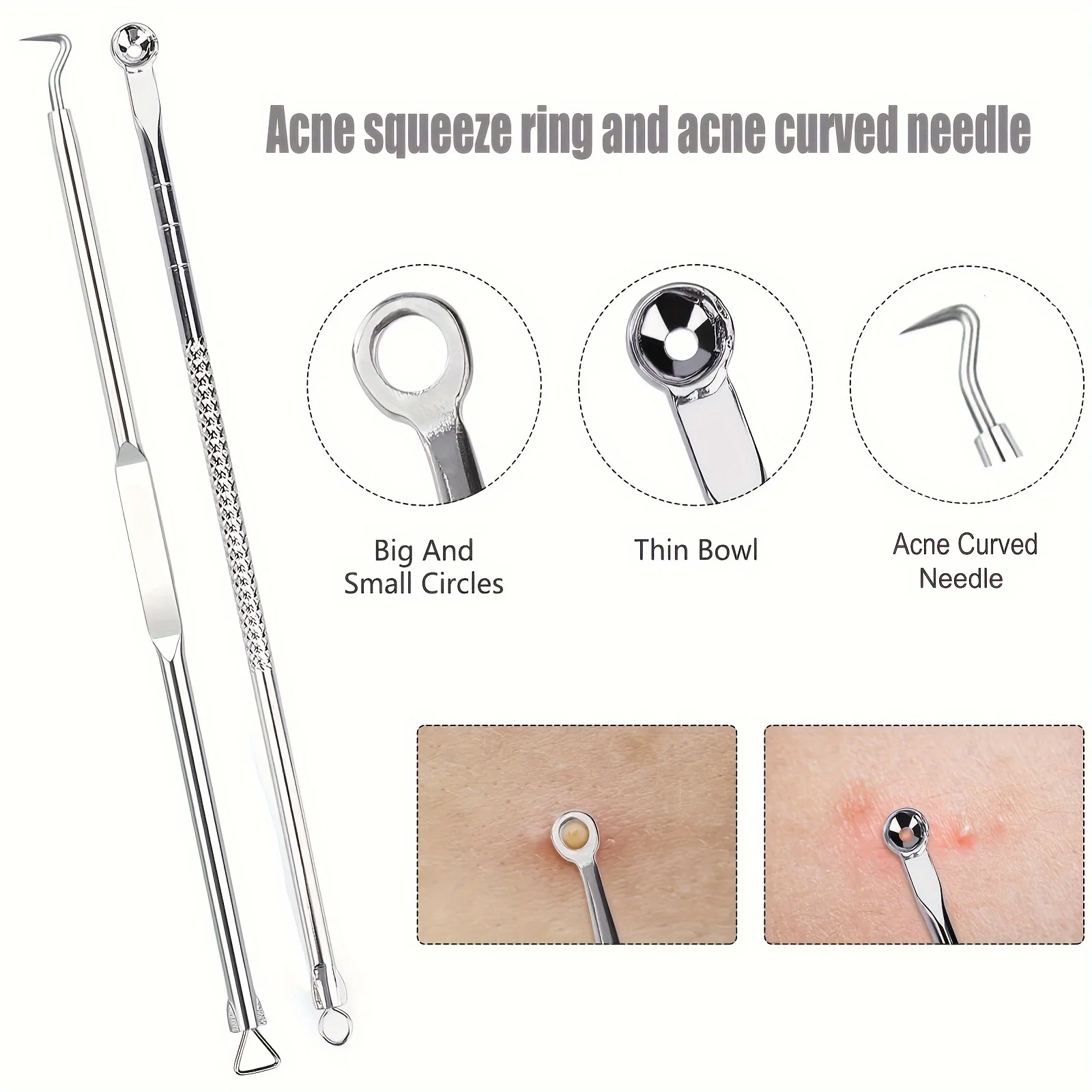 Stainless Steel Facial Care Beauty Kit. Suitable For Removing Nose Blackheads, Facial Acne And Facial Skin Blemishes