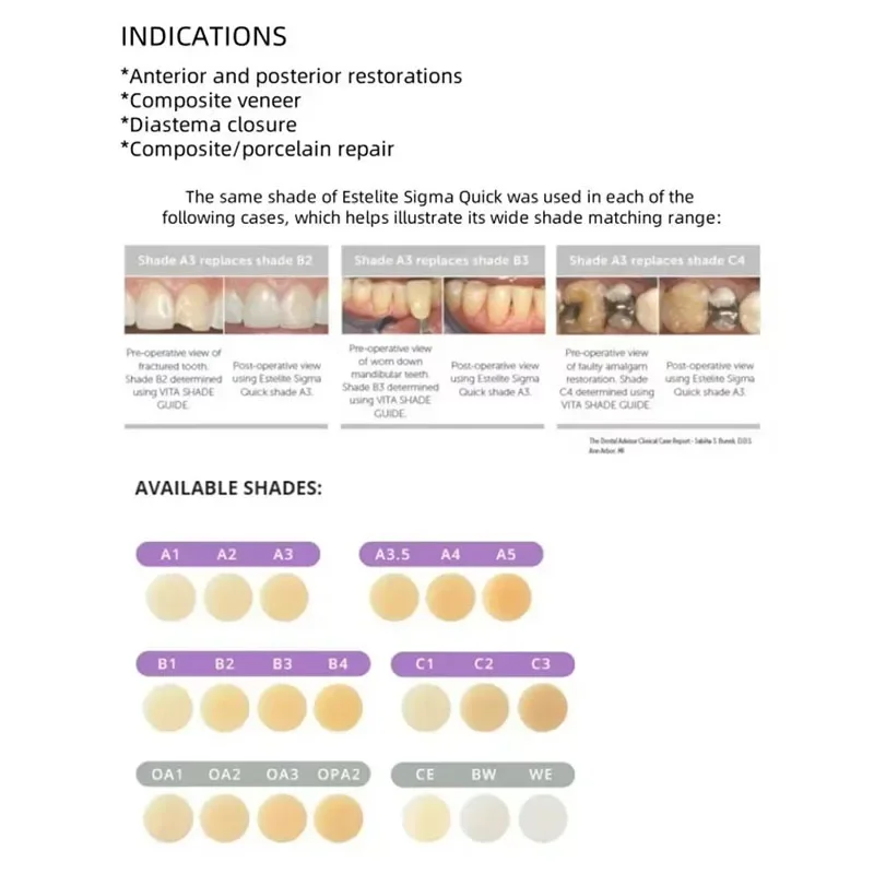 UV 치과 재료 경화성 레진 토쿠야마 팔피크 LX5 자가경화성 유니버설 접착제 구강 충전 수리 도구
