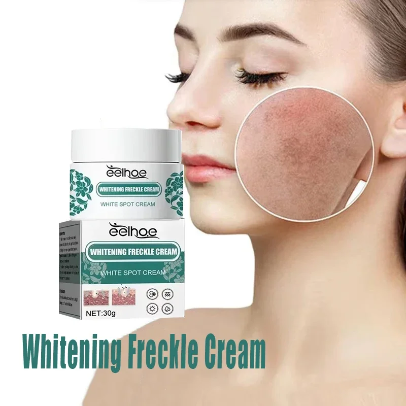 

Whitening freckle removing Cream Reduces Melanin Brightens Facial Cream Lightens Dull Skin Fine Lines Facial Care Serum