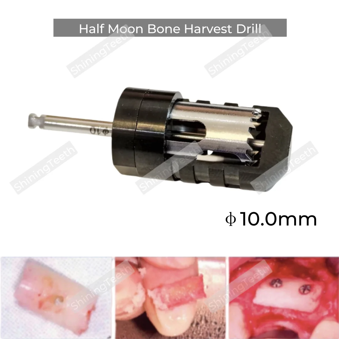 

10.0MM Dental Half Month Bone Drill Sampling Trephine Bur Incremental Bone Slice