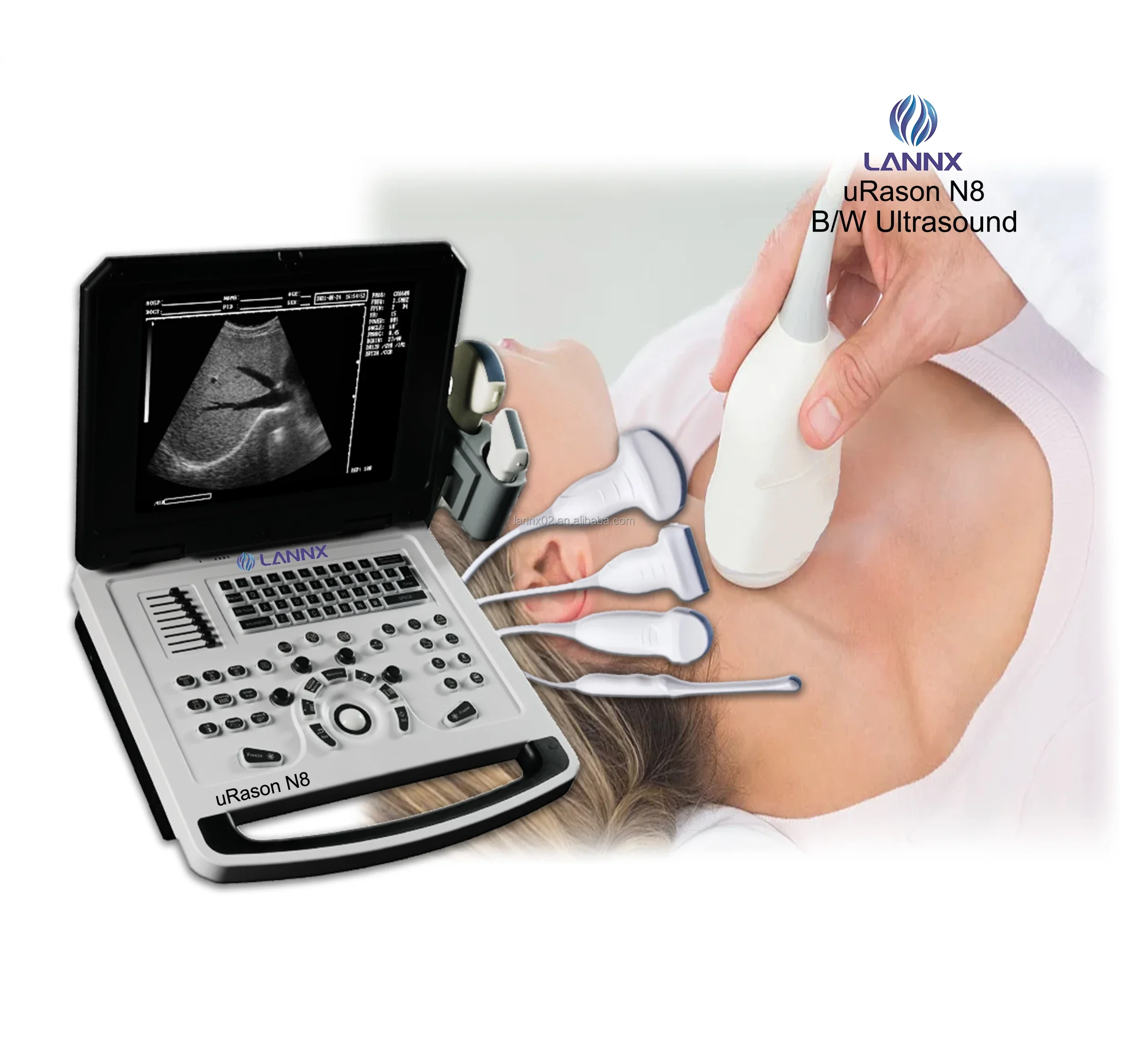 

uRason N8 LCD display Clinical Application Ultrasound Machine Portable Full Digital ultrasonic Scanner System