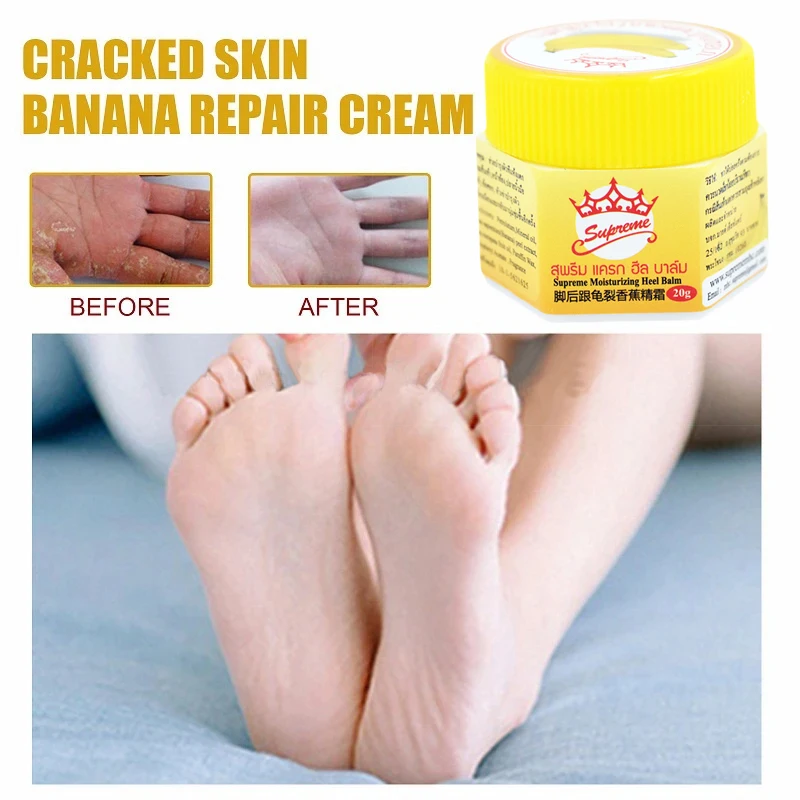 Snake Oil Chilblain Cream Hand Foot Crack Frostbite Dry Crack Skin Creams Heel Chapped Peeling Repair Ointment