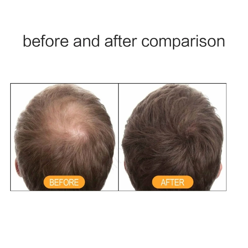 모발 관리를 위한 생강 모발 관리 샴푸를 가진 100ml 생강 샴푸 그리고 조절기