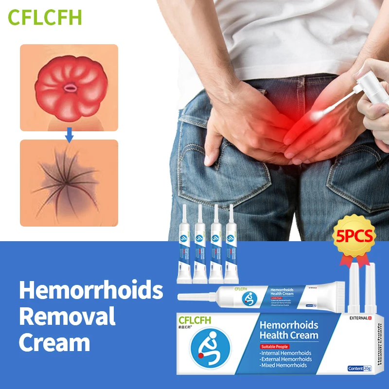 Hämorrhoiden Behandlung Creme Stapel Schmerz linderung Salbe indetale externe Hämorrhoiden Entfernung Anal fissur Blutung Schwellung Medizin