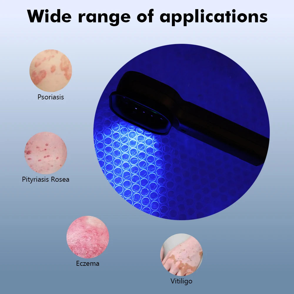 Woods Lamp Skin Analyzer UV Magnifying Portable Beauty Facial Testing Wood Lamp Light Skin Analysis Detection Skin Care Portable