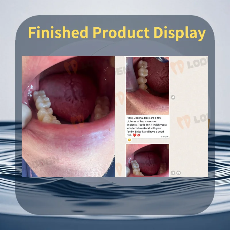 Рисунок 4 - LODDEN A1 A2 A3 A3