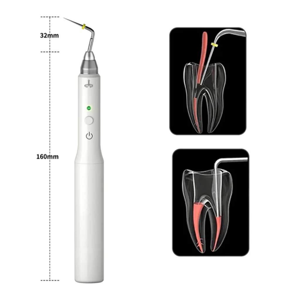 Dental Endo Heated Pen Cordless Gutta Percha Obturation System with 2 Tips Lab 3 Seconds Rapid Heating Endodontic Root Tools
