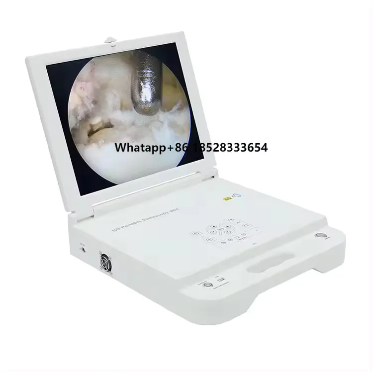 High Quality Rigid Nasopharyngoscope Full Hd Endoscope System Otolaryngology With Cold Light Source