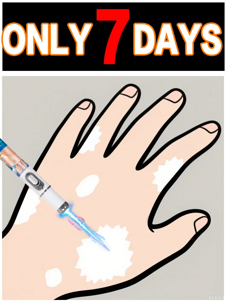 

Hot selling blue light pen to solve body vitiligo, vitiligo care tool