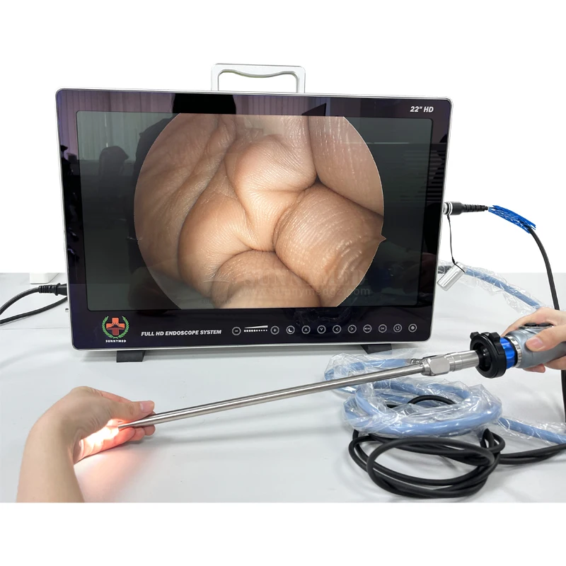 SY-PS050 Cheap key version endoscope  integrated endoscopy system machine for ent Laparoscopy