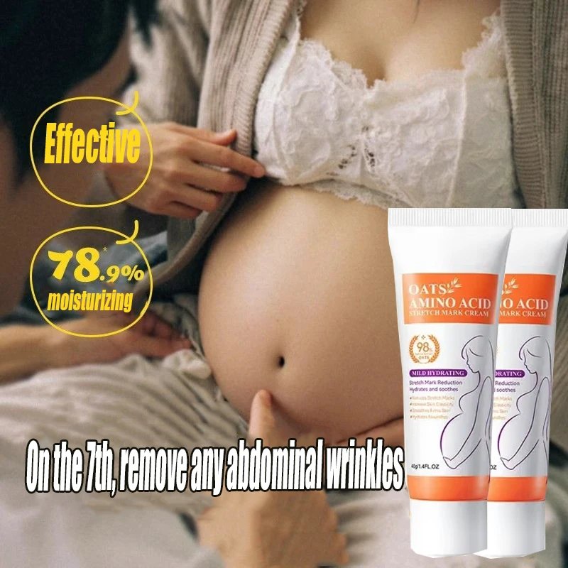 

Remove Skin Cracks Repair Firming Care Stretch Marks Moisturize Cream Eliminate Body Belly Stretch Marks Removal Swelling Marks