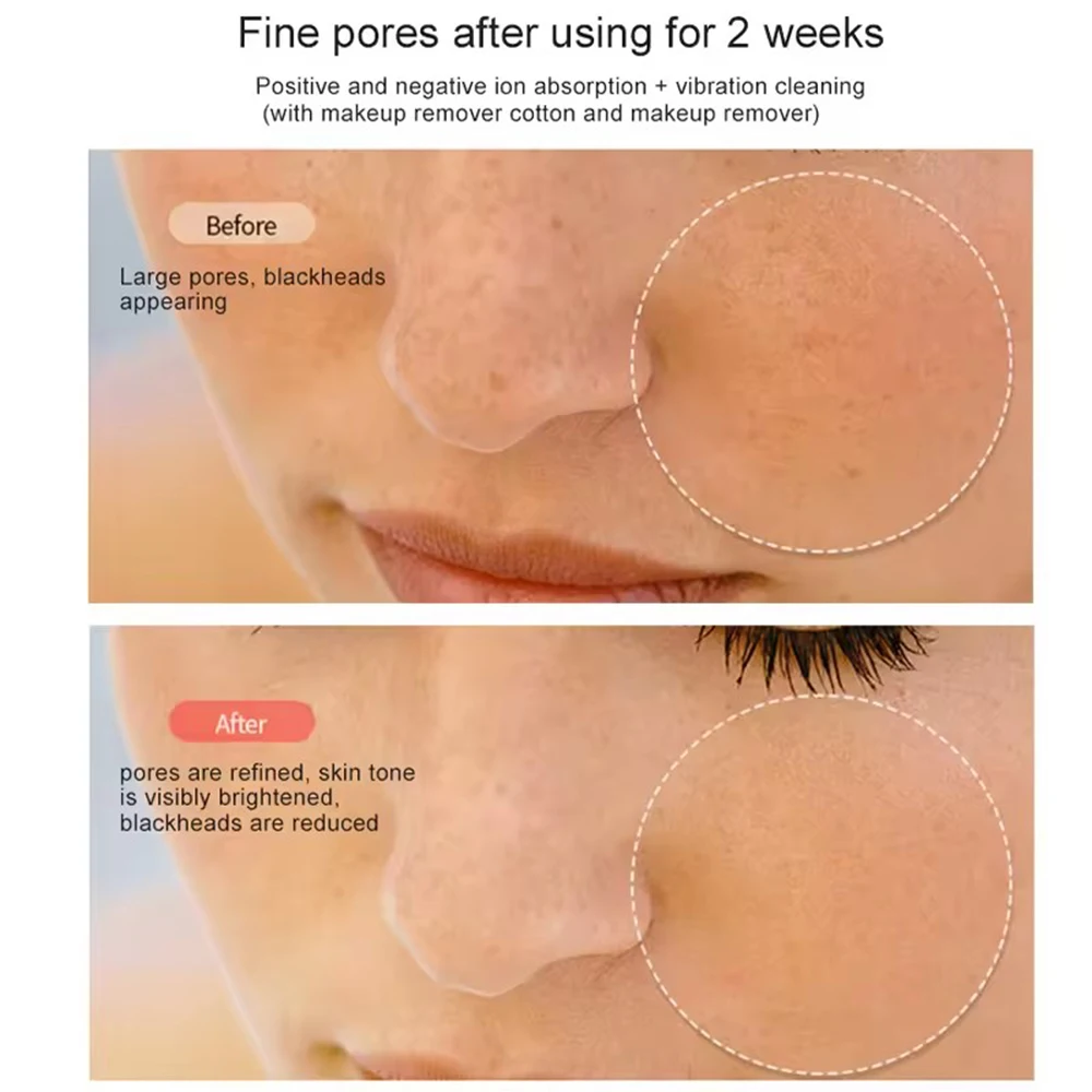 HIFU الوجه العناية بالبشرة EMS الوجه رفع مدلك LED الفوتون مزيل التجاعيد RF جهاز الجمال 1200 هرتز الاهتزاز مكافحة الشيخوخة جهاز #6