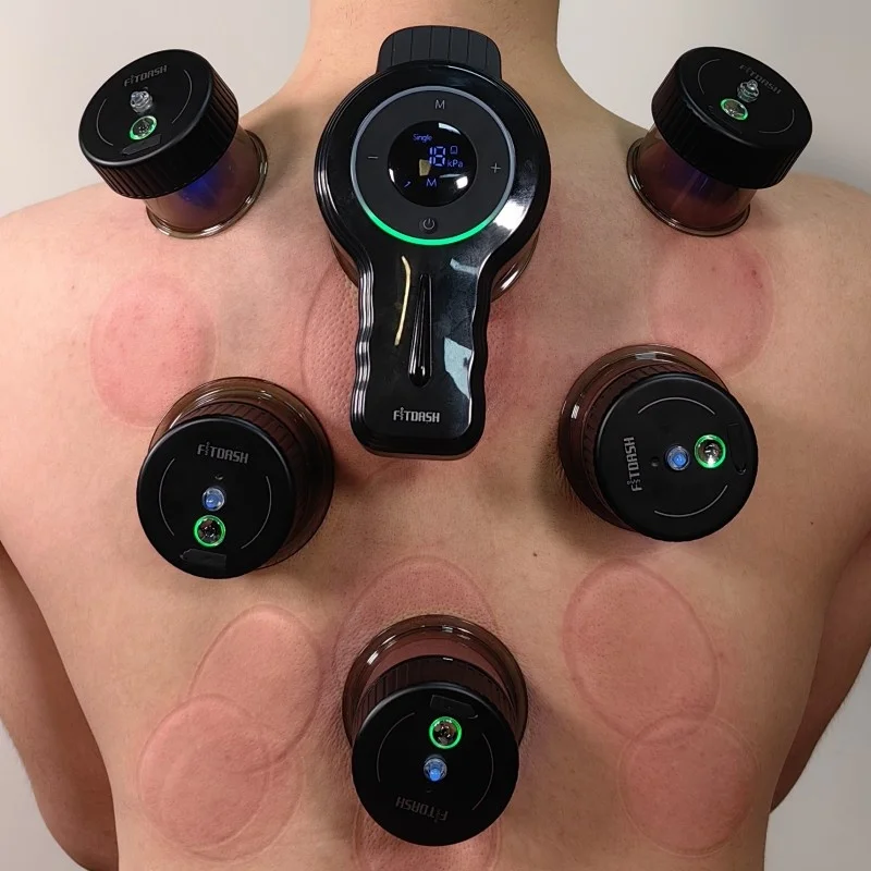 

Fitdash Rechargeable Smart Cupping Cups Therapy Massager Red Light Cupping Set Vacuum Cupping Therapy Equipment