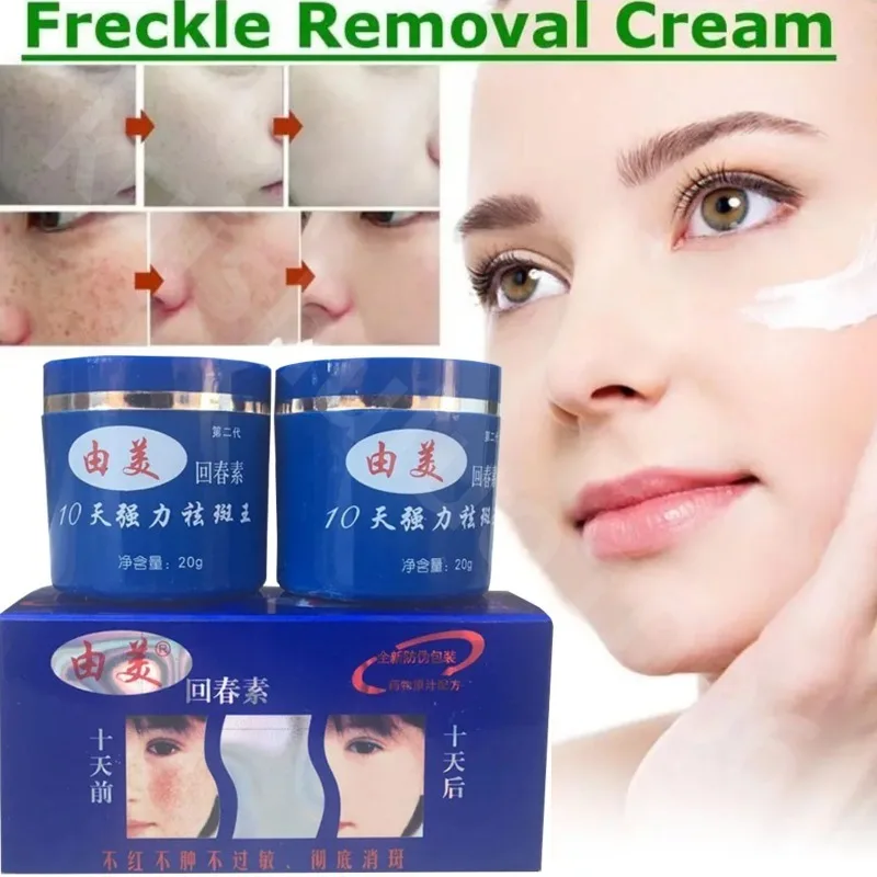 

10 DAYS Freckles Removal Day & Night Cream Remove Dark Spots Pigment Whitening and Brightening Skin Care