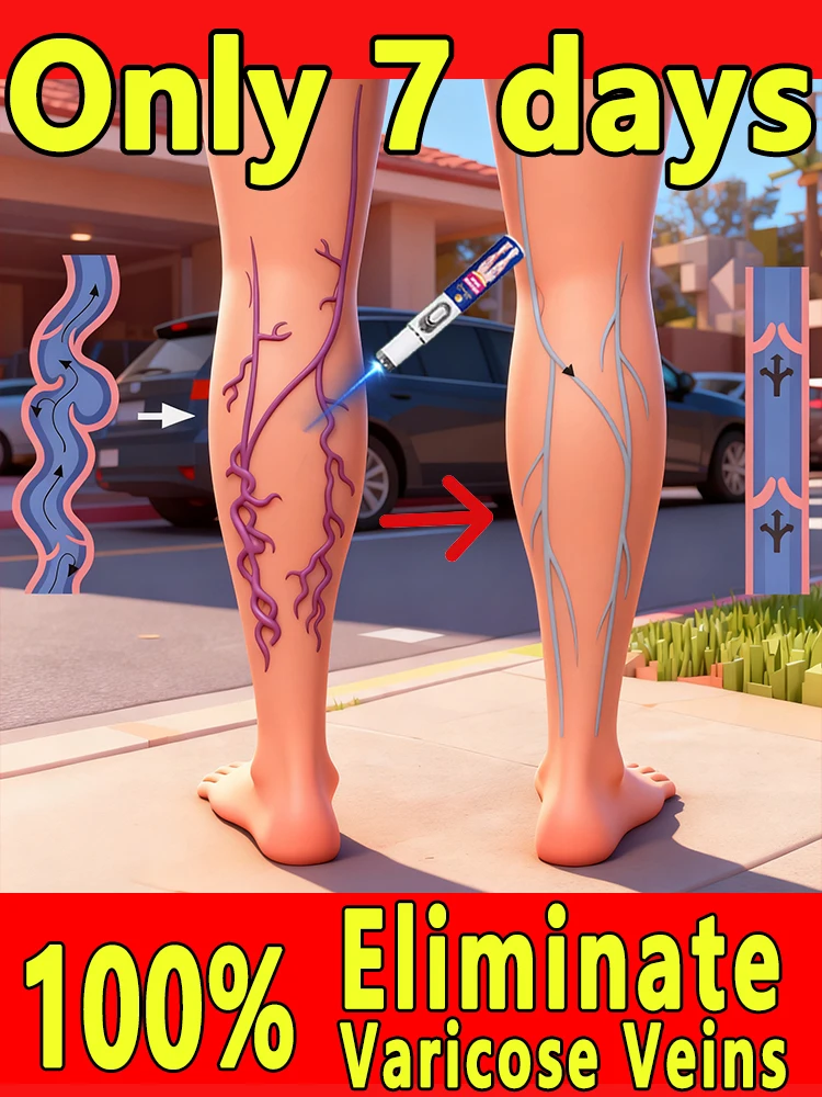 RᴇʟɪᴇғCᴀʀᴇ Pᴏʀᴛᴀʙʟᴇ Lᴇɢ Mᴀssᴀɢᴇʀ - Hᴏᴍᴇ Rᴇᴅ Lɪɢʜᴛ Tʜᴇʀᴀᴘʏ ᴛᴏ Rᴇʟɪᴇᴠᴇ Mᴜsᴄʟᴇ Fᴀᴛɪɢᴜᴇ ᴀɴᴅ Dɪsᴄᴏᴍғᴏʀᴛ #1