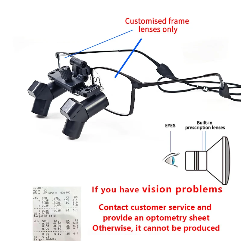 Lentile Prescripție Personalizate Myopia - usage example