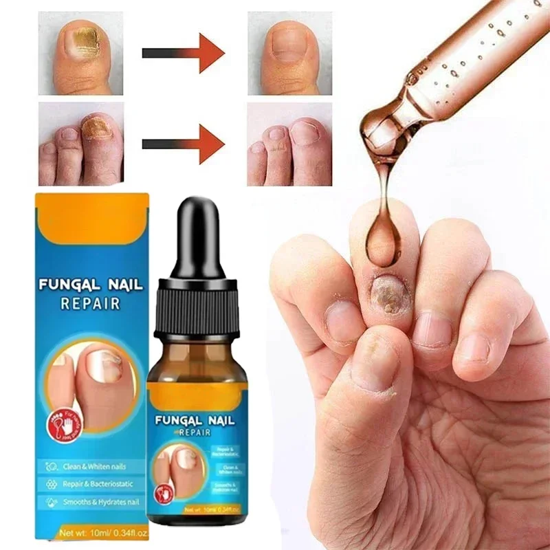 Nail Repair Solution Thickening Bright Nails Remove Onychomycosis Dead Skin Repair Moisturizing Nail Art Nutrient Care Solution