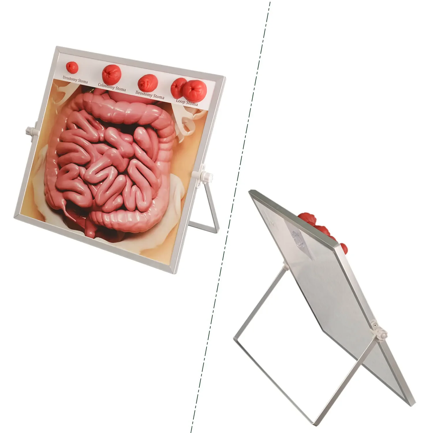 Ultrassist Ostomy Care Simulator Kit Educational Tool for Nurses Medical Students & Patient Guidance Hangable & Tabletop Design