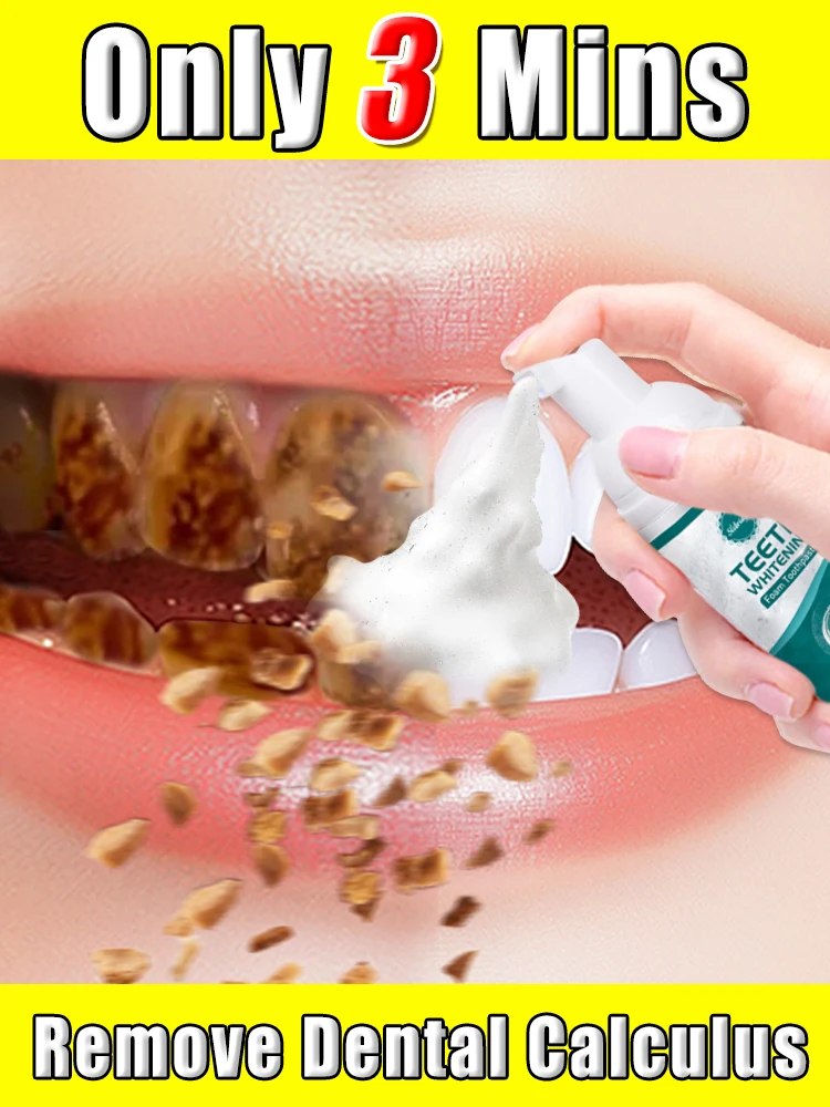 Dental Calculus Remover Teeth Whitening Mousse Cleaning Oral Hygiene Removal Halitosis Plaque Stains Fresh Breath Care