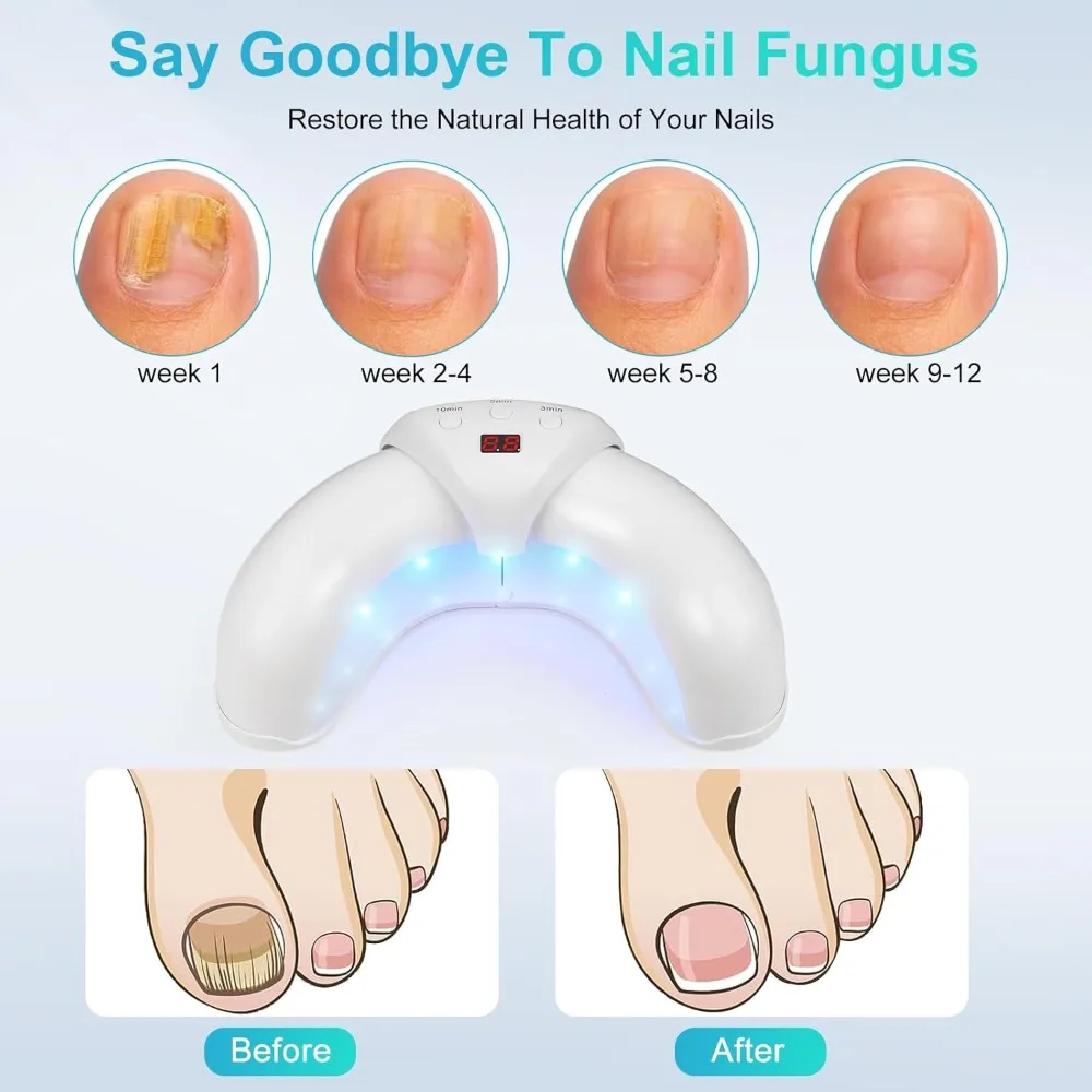 Nail Fungus Laser Treatment Device Repair Toenail Fingernail Fungus Treat Onychomycosis Therapy Cure Machine Effectively Remove