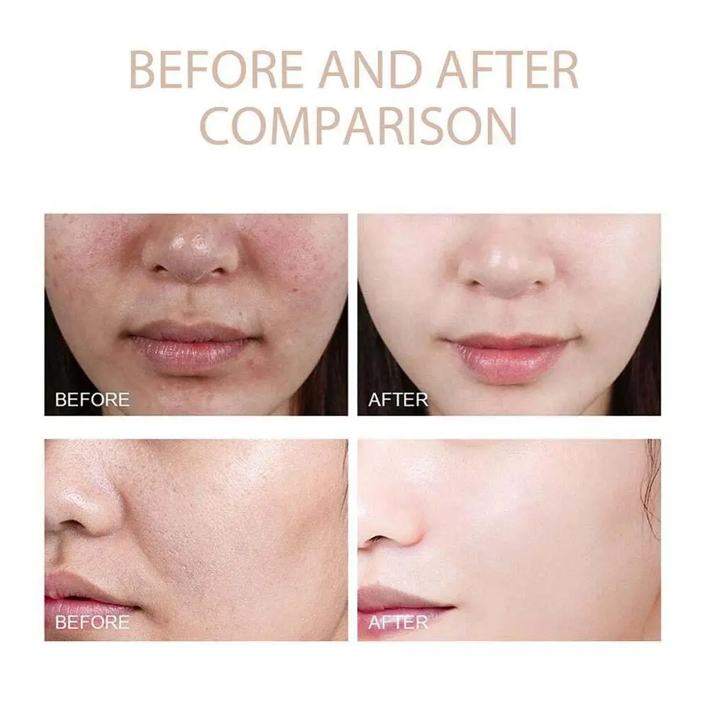 الكورية الدكتور ميلاكسين الأرز التقشير جوهر تفتيح التحكم ترطيب السيطرة على النفط ترطيب المسام تقلص لطيف العناية بالبشرة