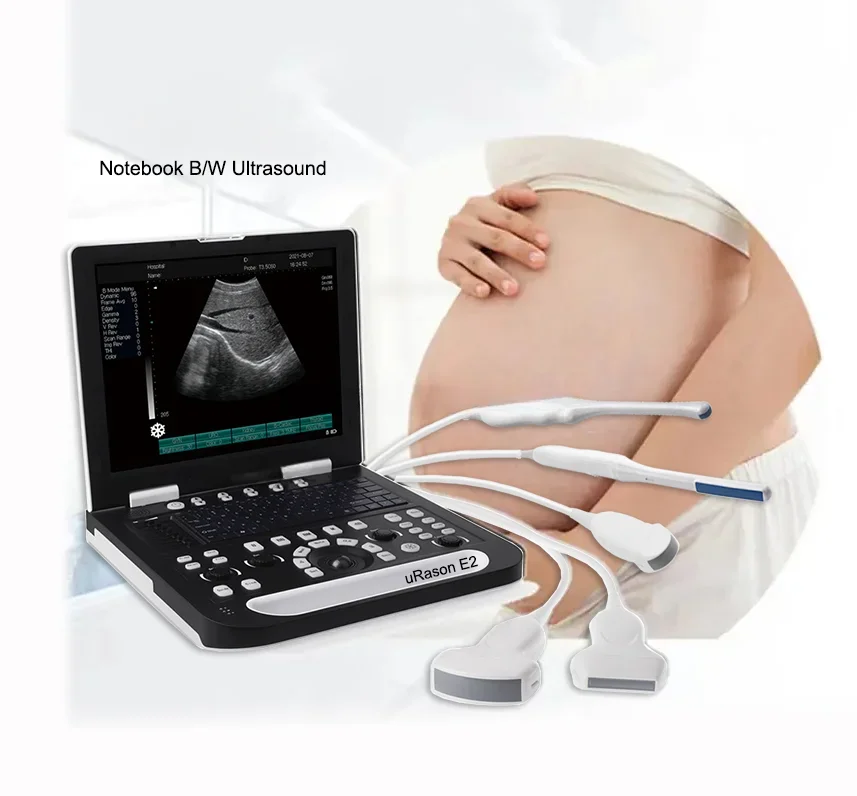 uRason E2 Laptop Echo Photography Black and White Instrument Medical Ultrasound Scanner System Human ecografo portatil