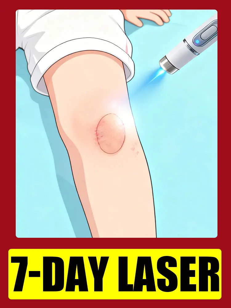 

Самый продаваемый продукт Лазерные ручки для шрамов