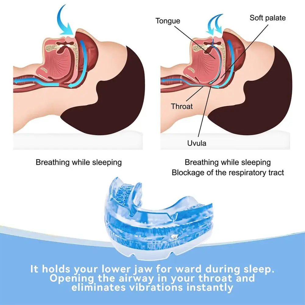 Protector bucal antirronquidos, boquilla ajustable, protector bucal nocturno para dientes y mordedura para dormir, bruxismo y dejar de roncar