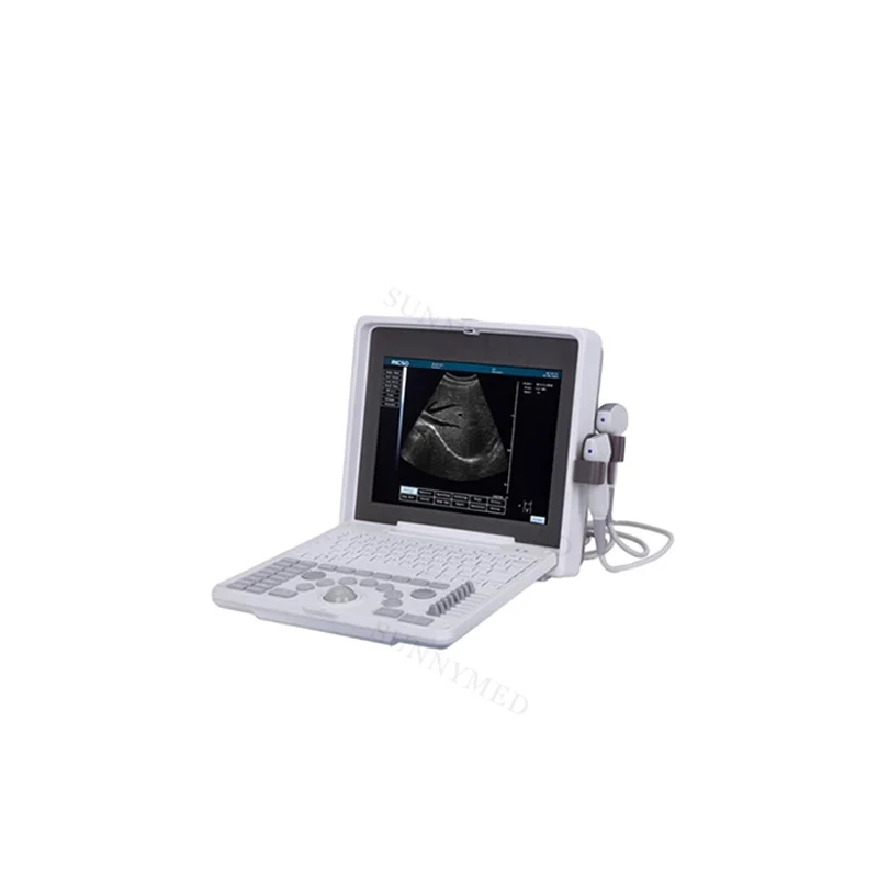 

SY-A003 B ultrasound machine