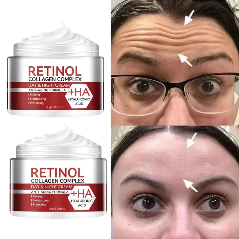 

Collagen Retinol Facial Cream Lightening Brightening Skin Color Hyaluronic Acid Moisturizing Rejuvenate Skin Care Face Creams