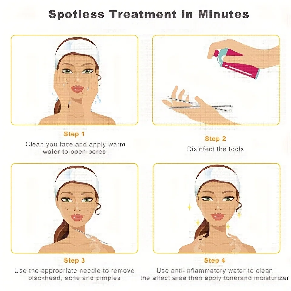 مجموعة مكونة من ثماني قطع من إبرة مشبك الخلية الدقيقة لصندوق حديد، ملاقط الرؤوس السوداء من الفولاذ المقاوم للصدأ، مجموعة أدوات إزالة منزلية #3