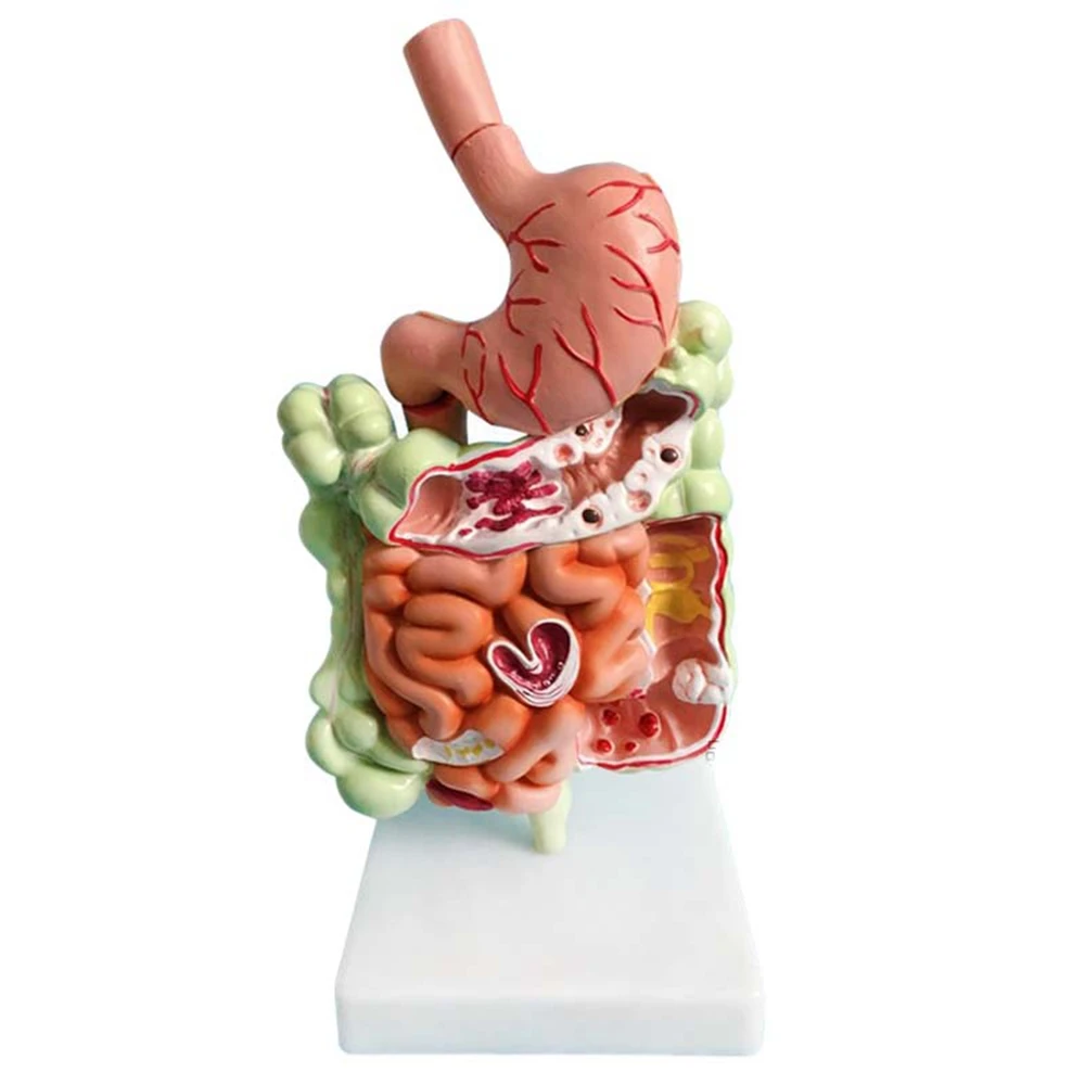 ABJF-Human Digestive System Model Stomach Anatomy Large Intestine Cecum Rectum Duodenum Human Internal Organs Structure Model
