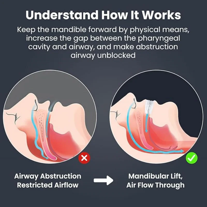 2/4PCS Anti Snoring Bruxism Sleeping Mouth Guard Night Guard Gum Shield Mouth Tray Stop Teeth Grinding Sleep Apnea Mouthpiece image 2