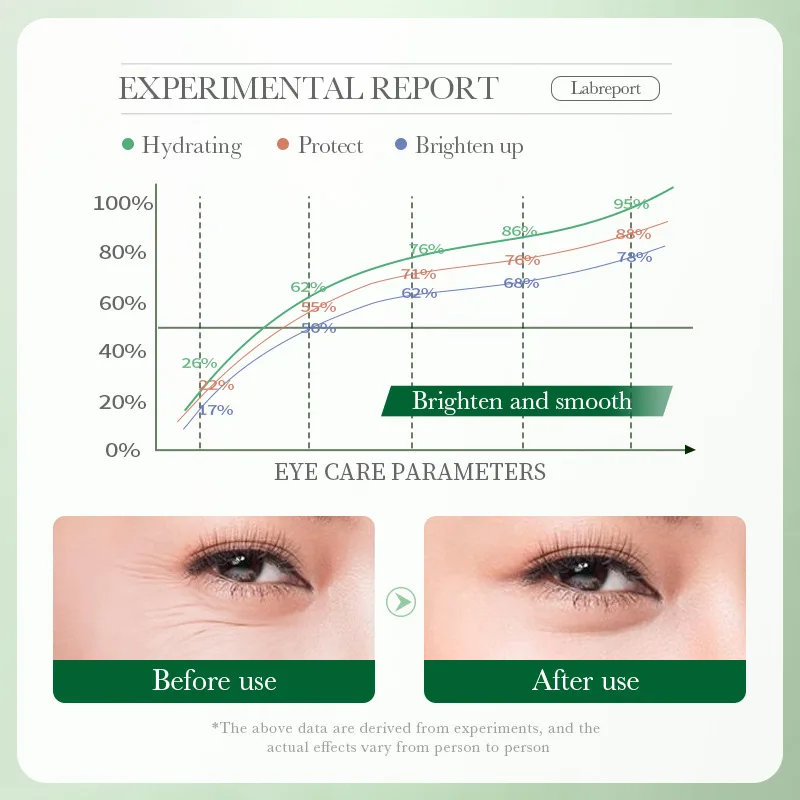 Centella Asiatica Eye Cream Anti Dark Circles Eyes Bags Moisturizing Anti Wrinkle Anti-aging Beauty Eyes Skin Care Products