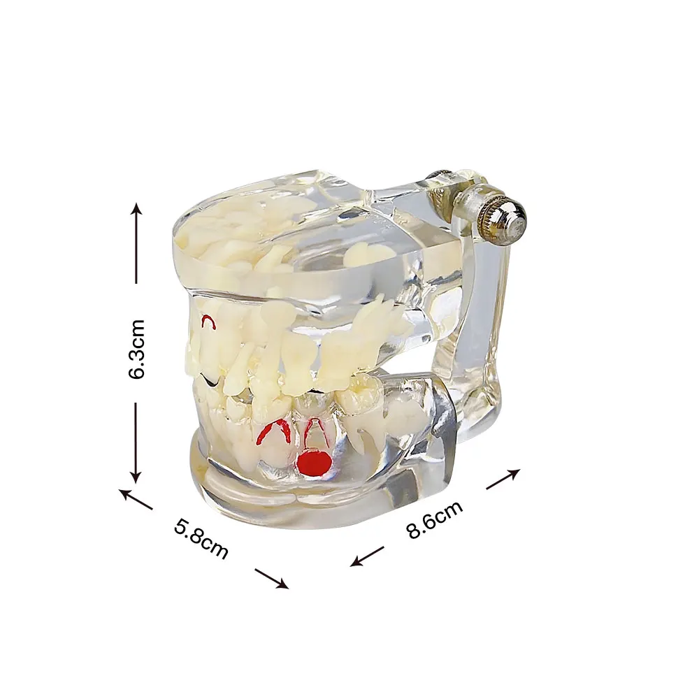 โมเดลฟันปลอมฟันพื้นฐานและฟันแท้ของเด็กสลับกันกับโรคฟันผุเครื่องมือทันตกรรมโมเดลทันตแพทย์