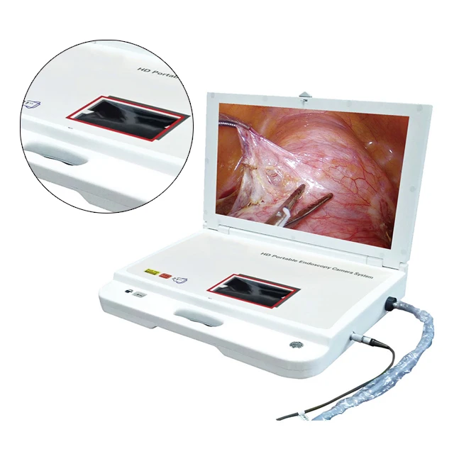 

Hospital Machine Digital Video Portable Endoscope System