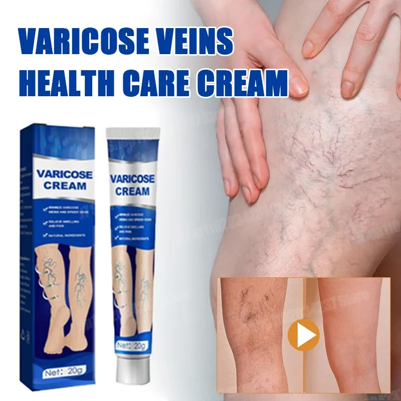 Improvement of moderate varicose veins, relief of pain, and improvement of blood circulation