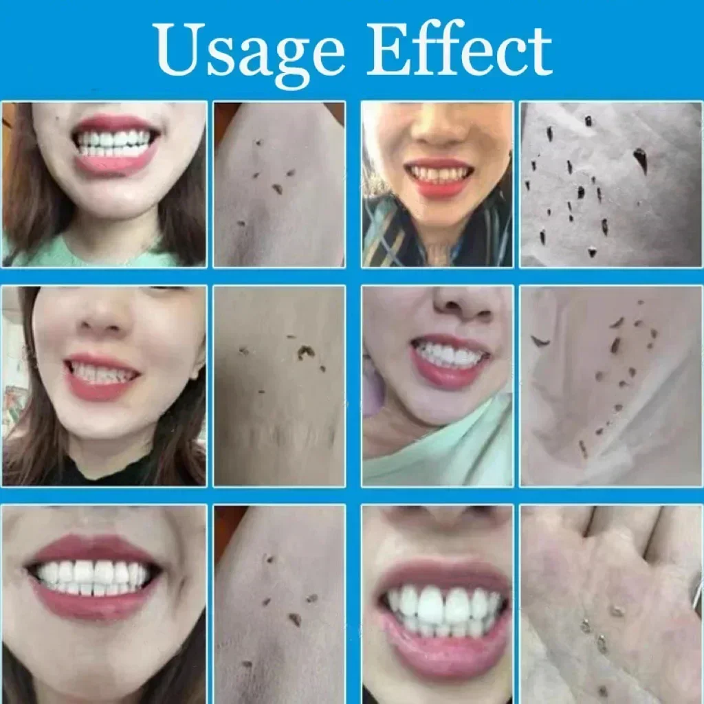 مزيل حساب التفاضل والتكامل الأسنان تبييض الأسنان رذاذ معجون الأسنان تنظيف نظافة الفم إزالة الكريهة البلاك البقع العناية بالنفس الطازج #6