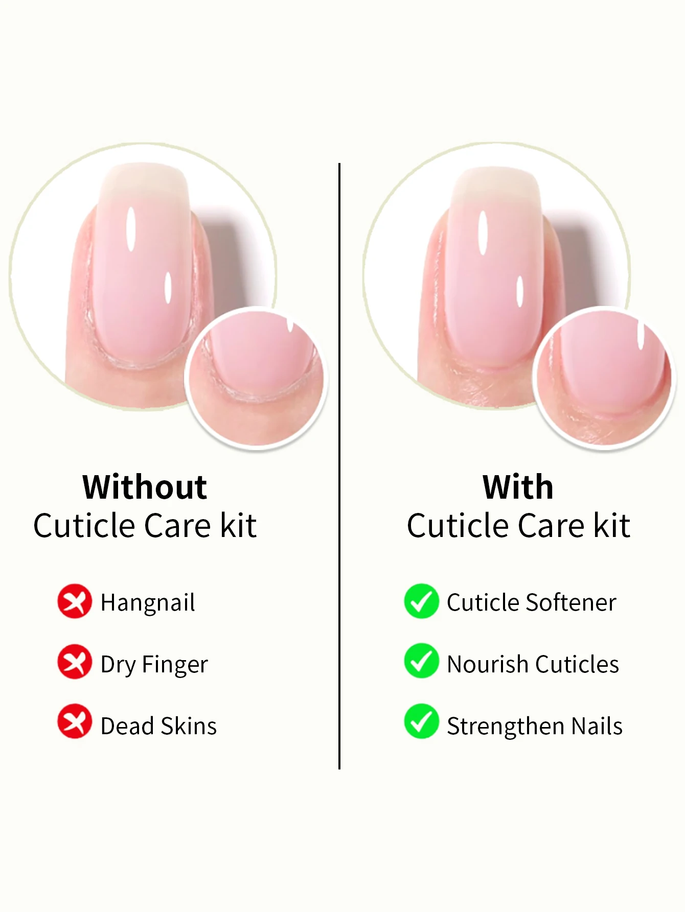 น้ำมันบำรุงเล็บ RS 25 มล. น้ำยาล้างหนังกำพร้า ซ่อมแซมและทำให้หนังกำพร้าอ่อนนุ่ม ชุดดูแลเล็บครบวงจรเพื่อเล็บที่แข็งแรง